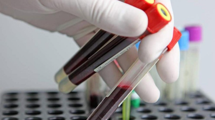 DİQQƏT!  Bu analizlər pulsuzdur