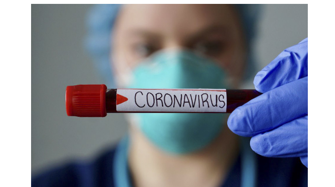 Bu gün daha 433 nəfər koronavirusa yoluxub, 12 nəfər ölüb 