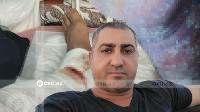 Mübariz Mənsimova məxsus şirkətin gəmisində yanan şəxs kompensasiya ala bilmir - FOTO 