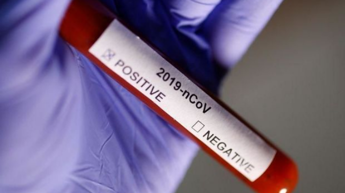 Koronavirusla bağlı SON STATİSTİKA 