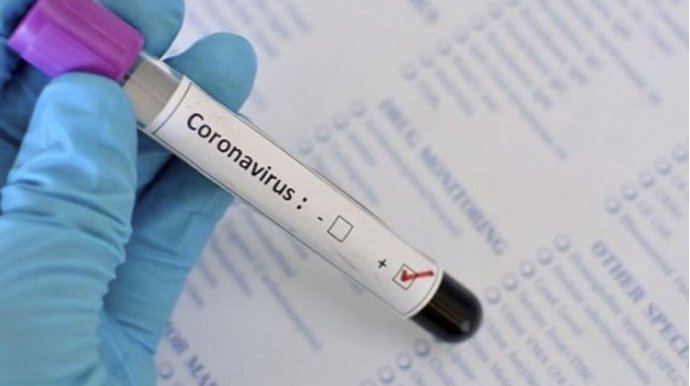 Türkiyədə gizli yas mərasimində 163 nəfər koronavirusa yoluxub