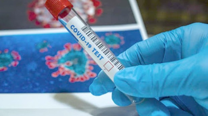 Azərbaycanda koronavirusa yoluxanların sayı AÇIQLANDI 