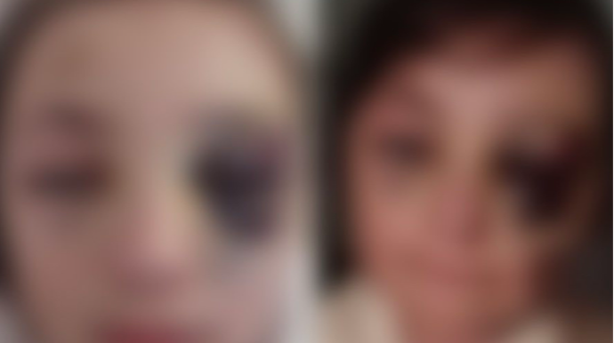 Məktəbdən döyüldüyü deyilən şagirdlə bağlı açıqlama   - FOTO - YENİLƏNİB