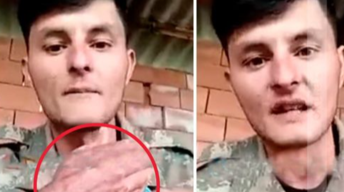 Vətən müharibəsi qazisinə niyə əlillik verilmir? - AÇIQLAMA