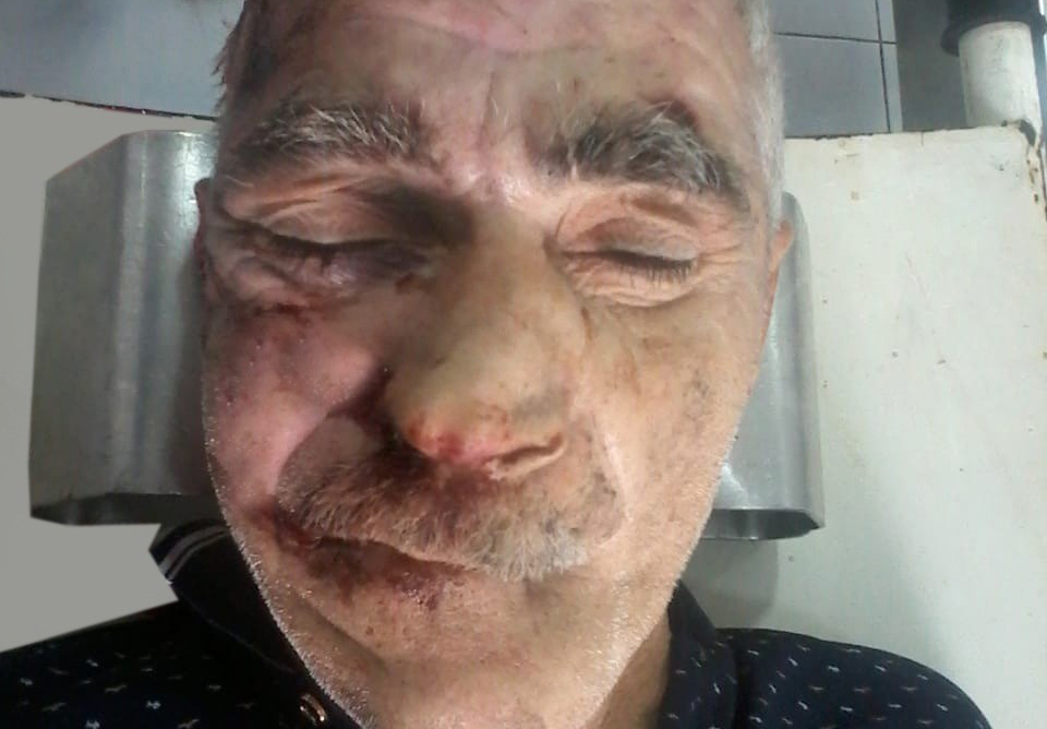 Polis maşınla vurulub öldürülən şəxsin yaxınlarını axtarır - FOTO