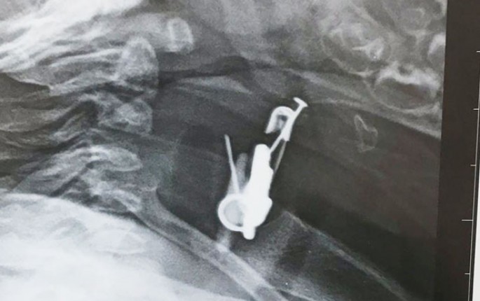 Gözdəyməmək üçün vurmuşdular, körpə uddu - Azərbaycanda - FOTO