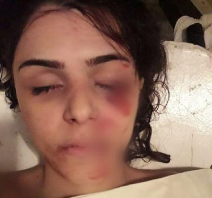 Xırdalanda 4 gün əvvəl qəzada ölən qadının yaxınları axtarılır - FOTO