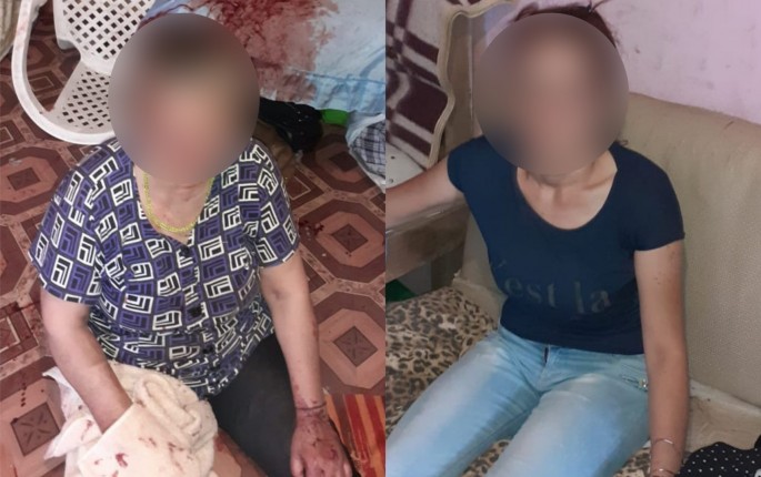 Bakıda qayınanasına xəsarət yetirən kişi həbs edilib