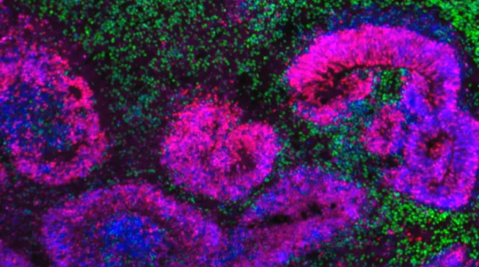 Alimlər beyin atlası tərtib etdilər 