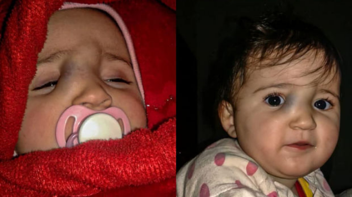 İki yaşlı Zeynəbə dəstək olaq  - FOTO