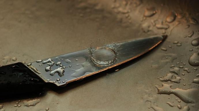 Bakıda 26 yaşlı gənc ayağından bıçaqlandı