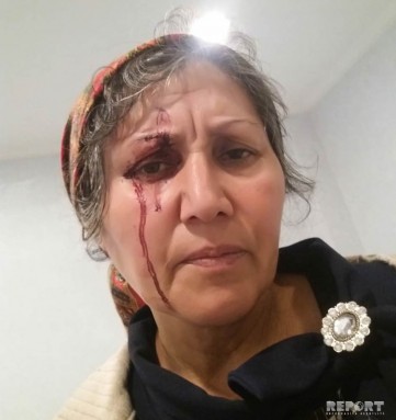 Masallıda 4 nəfər evə hücum edərək ər və arvadı bıçaqlayıb - FOTO