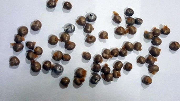 İran vətəndaşının daxili orqanında narkotik və psixotrop maddə aşkarlanıb