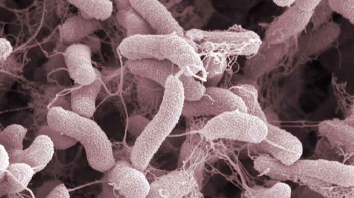 Bir milyarddan çox insan vəbaya yoluxma riski altındadır - XƏBƏRDARLIQ 