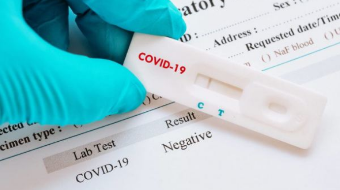 Azərbaycanda son sutkada 31 nəfər koronavirusa yoluxub 