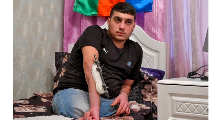 Началось изготовление протеза для лишившегося обеих ног 20-летнего участника Карабахской войны