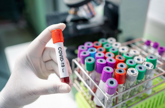 Azərbaycanda daha 56 nəfər koronavirusa yoluxub, 53 nəfər sağalıb