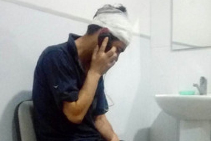 Metro yaxınlığında 32 yaşlı kişi soyuldu - VİDEO