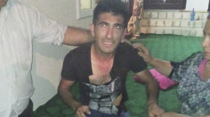 “Qara maskalı şəxs mənə iynə vurmağa çalışanda qışqırdım, qaçdı”  - FOTO - VİDEO