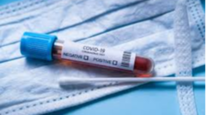 İTV-nın böyük redaktoru koronavirusa yoluxub, vəziyyəti ağırdır 