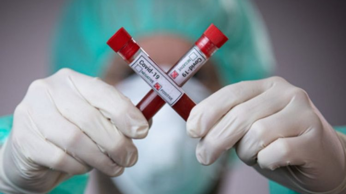 Üç rayon Bakıda virusa yoluxmaya görə öndədir - SİYAHI 