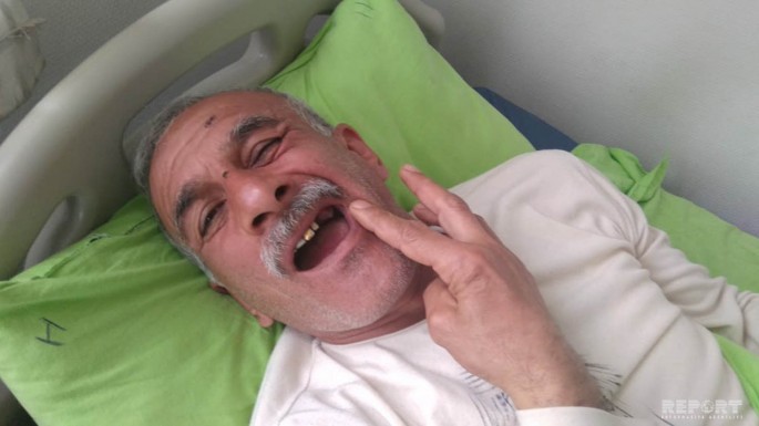 Lənkəranda kütləvi dava olub, xəsarət alan var