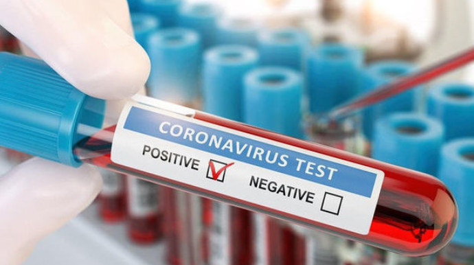Обнародована последняя мировая статистика по коронавирусу