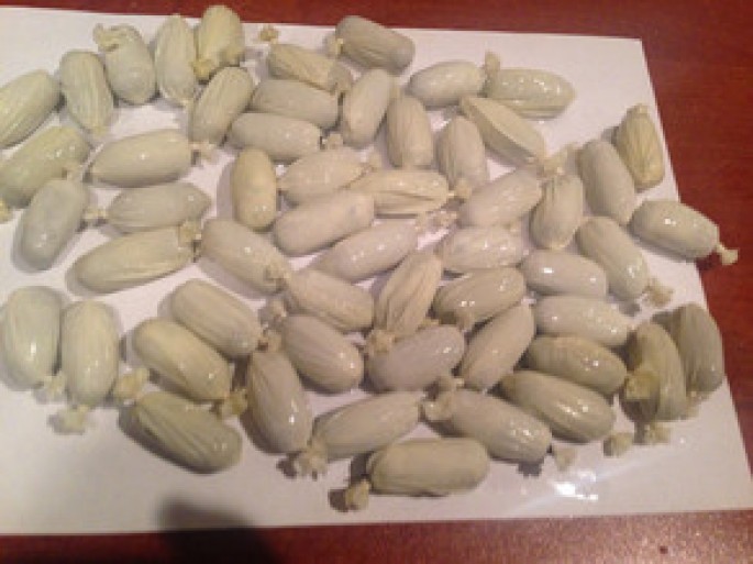 Azərbaycan vətəndaşının daxili orqanında narkotik vasitə və psixotrop maddə aşkar edilib