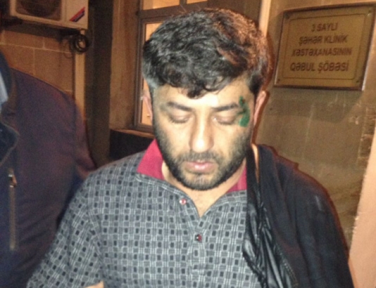 Yol polisləri tərəfindən döyüldüyü deyilən sürücü danışdı - FOTO