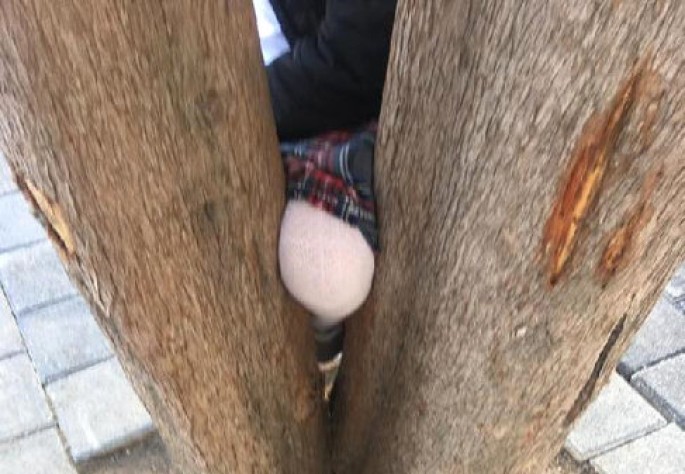 Məktəblinin ayağı ağacın arasında qaldı – FOTO