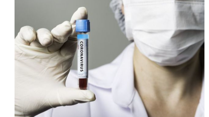 Azərbaycanda daha 32 nəfər koronavirusdan öldü: 1064 yeni yoluxma