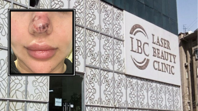 Rəna Soltanovanın daha bir qurbanı danışdı: "İşimdən oldum, külli miqdarda pul itirdim" 