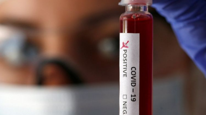 Dünyada koronavirusa yoluxanların sayı 33 milyon 464 minə çatıb