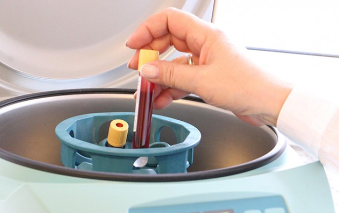 Azərbaycanda daha 25 nəfərdə koronavirus aşkarlandı - 1 nəfər öldü, 122-si sağaldı