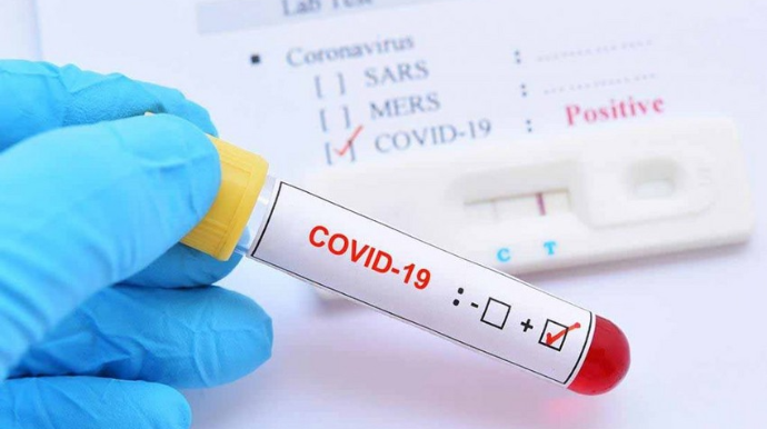Azərbaycanda son sutkada 11 nəfər koronavirusa yoluxub, ölən olmayıb 