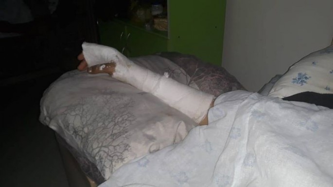 Tovuzda minik avtomobili qayaya çırpılıb, 7 nəfər xəsarət alıb