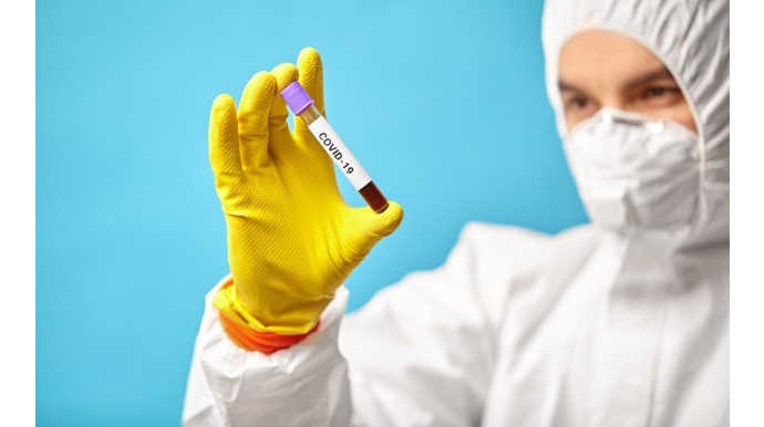 Azərbaycanda son sutkada 1101 yeni yoluxma faktı qeydə alınıb