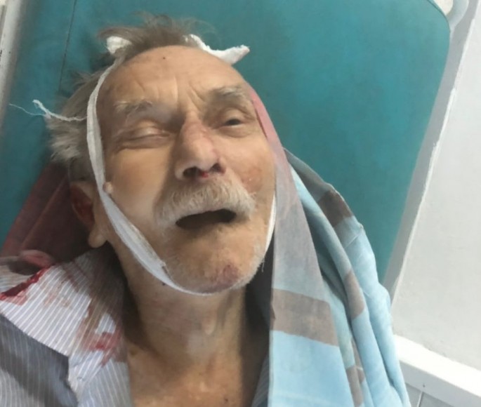 Avtomobilin vurub öldürdüyü piyadanın yaxınları axtarılır – FOTO