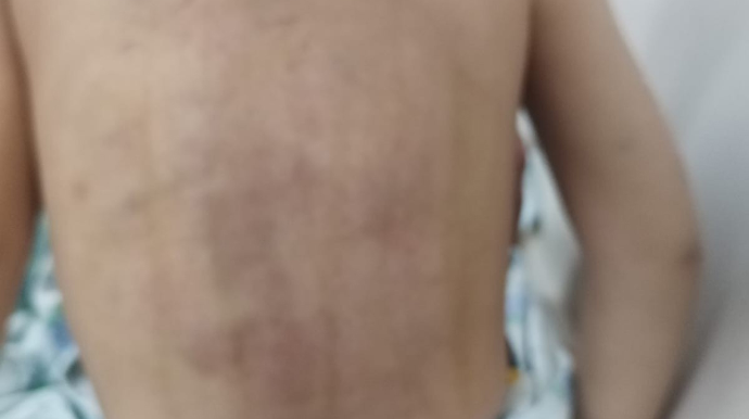 Lənkəranda atalığı 3 yaşlı uşağı döyüb? - FOTO