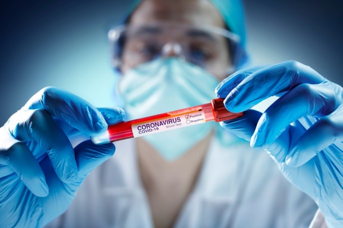 Azərbaycanda daha 38 nəfər koronavirusa yoluxub, 58 nəfər sağalıb