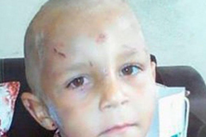 Bakıda döyülüb küçəyə atılan 4 yaşlı uşaqla bağlı DƏHŞƏTLİ FAKTLAR - VİDEO