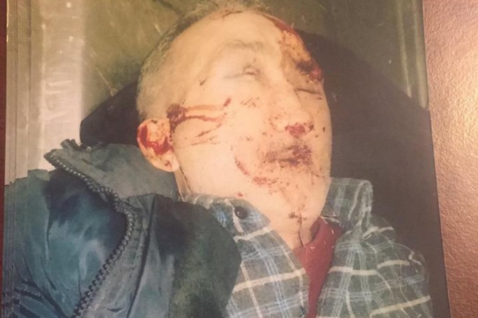 Maşınla vurulub öldürülən piyadanın yaxınları axtarılır - FOTO