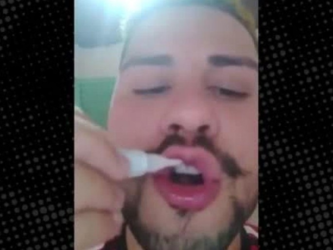 Dodağına yapışqan sürtüb, sevgilisi ilə öpüşdü, ayıra bilmədilər - VİDEO