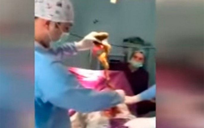 Qadının mədəsindən elə şeylər çıxdı ki... - Bakıda şok - VİDEO