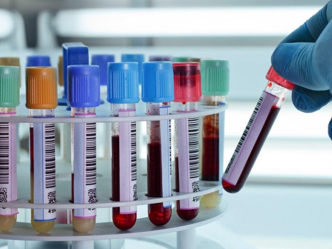 Aşura günü qan verən 1 nəfərdə QİÇS, 116 nəfərdə Hepatit C, 96 nəfərdə Hepatit B aşkarlanıb