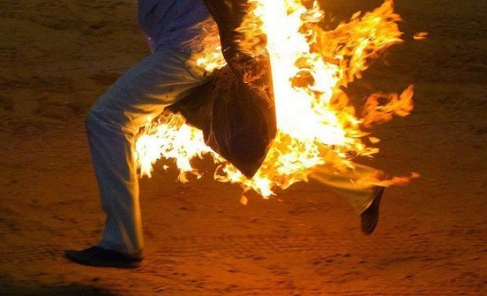 Qadın telefon şifrəsinə görə ərini yandırdı - FOTO