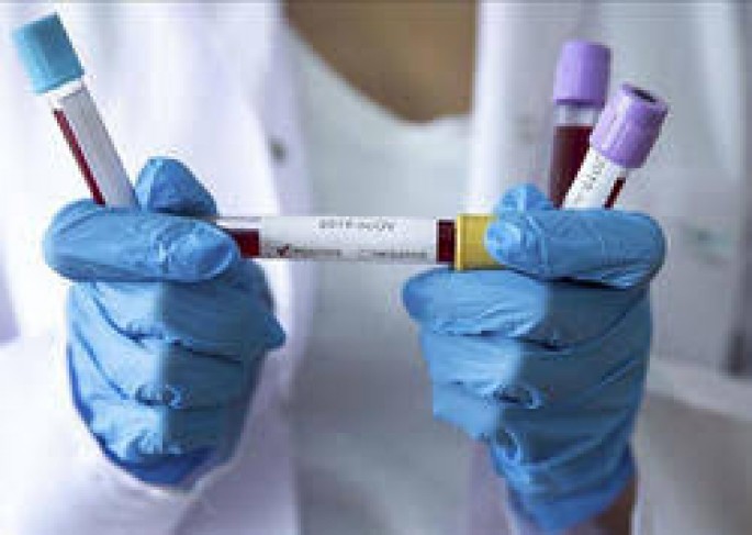 Azərbaycanda daha 143 nəfər koronavirusa yoluxub, 44 nəfər sağalıb