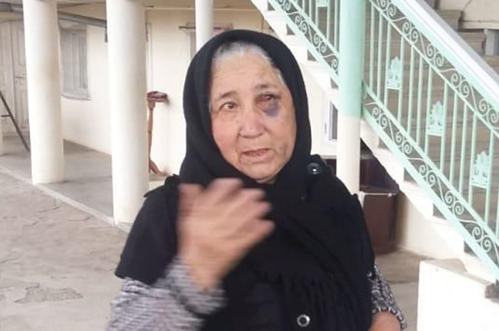 Evə basqın edən maskalı şəxslər yaşlı ev sahibinə xəsarət yetirdilər - FOTO