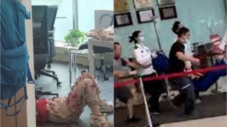 Çində bıçaqlı qadın ətrafında olanlara hücum edib  - VİDEO