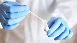 Vətəndaşlardan COVID-19 testi niyə iki dəfə götürülür? - RƏSMİ AÇIQLAMA 